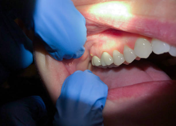 Best Emergency Dentist Near Me  in Crestwood, MO